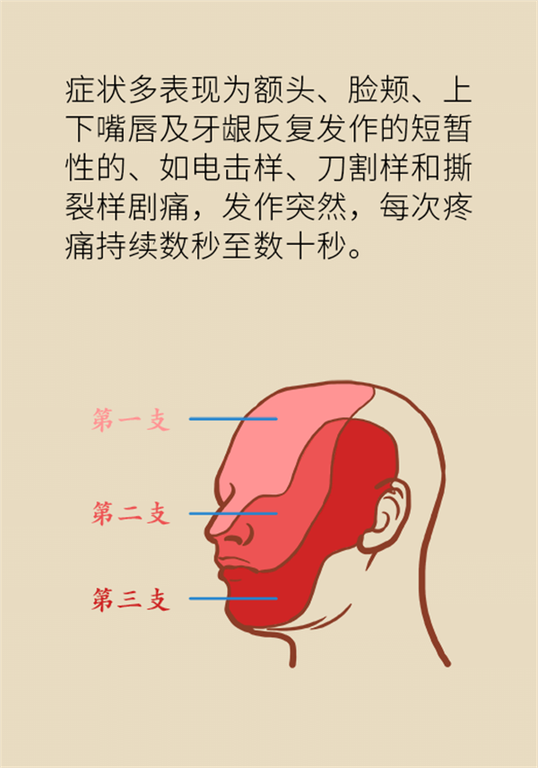 這種疼痛不是牙疼？緩解三叉神經(jīng)痛就用這兩招
