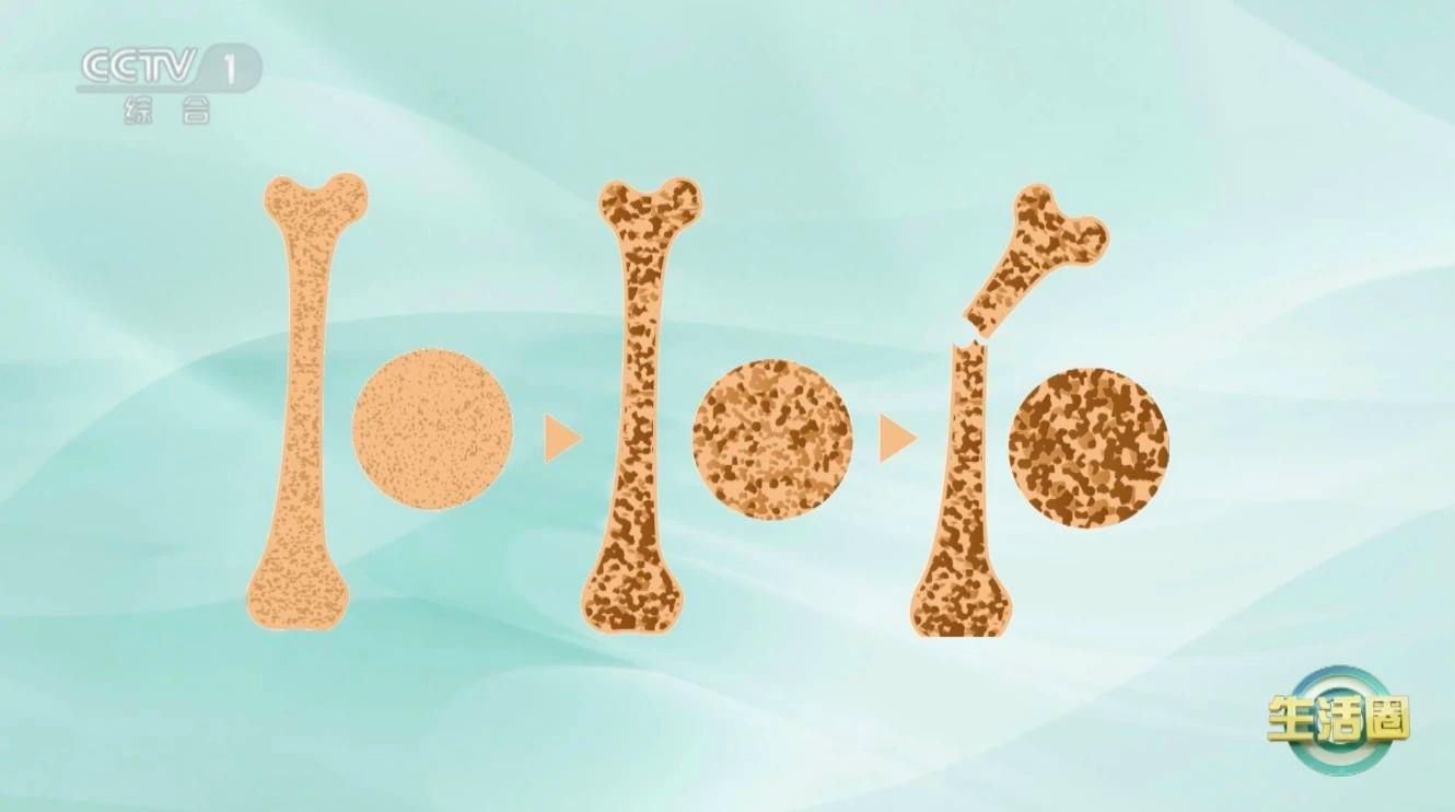 血管堵沒堵？走兩步！出現(xiàn)這6個(gè)信號就要當(dāng)心