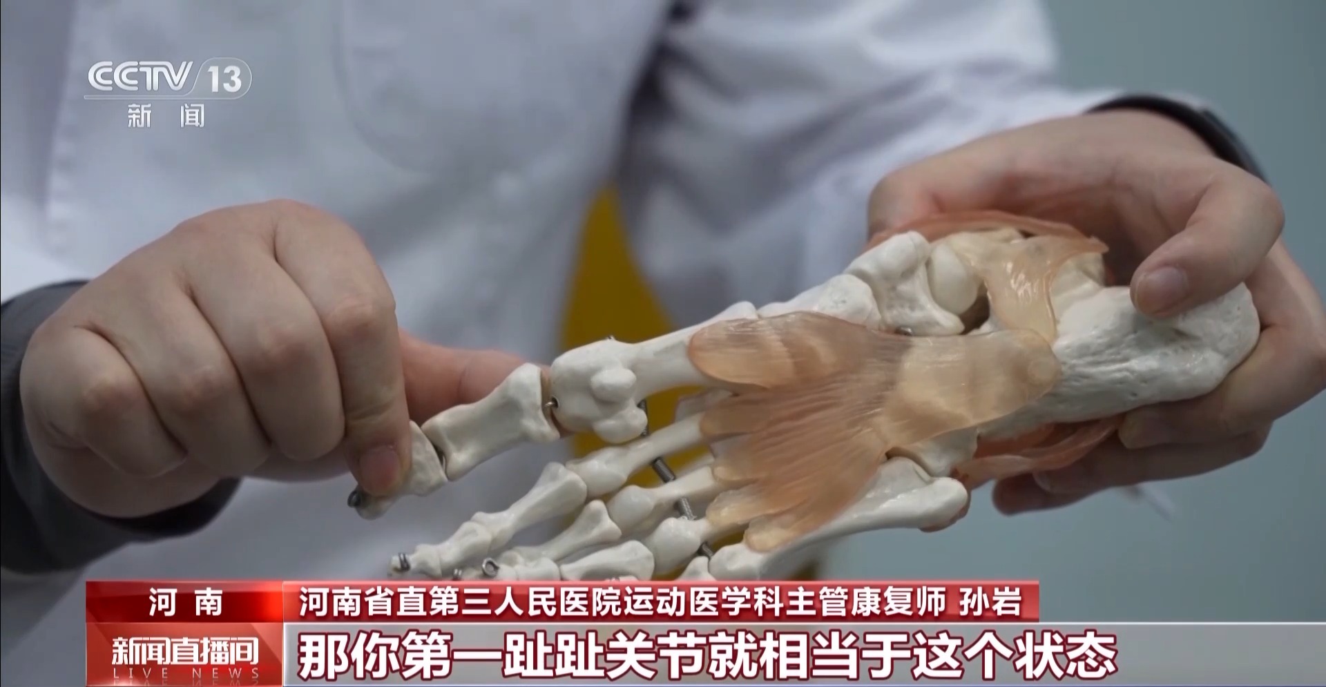 瘋狂種草碳板跑鞋？醫(yī)生：足底筋膜炎警告！
