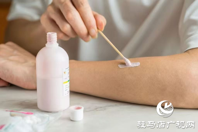爐甘石洗劑并非“萬(wàn)能神藥” 這些情況要慎用！