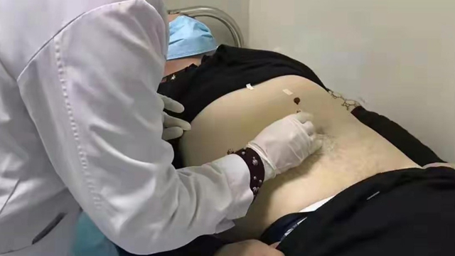 駐馬店市中醫(yī)院推廣穴位埋線減肥：新興療法受青睞 輕松享"瘦"