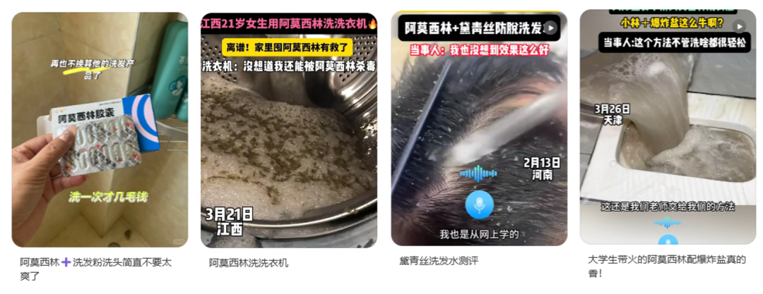 用阿莫西林洗頭，能治療脫發(fā)？別信！