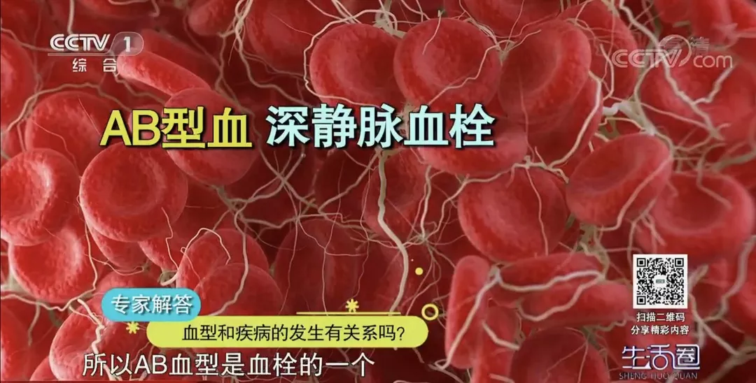 A型血的人易患冠心病 其他型血的人易患……