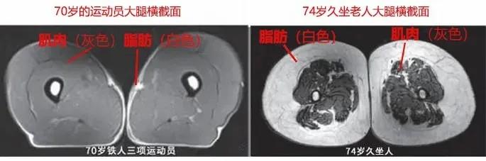 運(yùn)動(dòng)是加速衰老，還是延緩衰老？真相揭開(kāi)